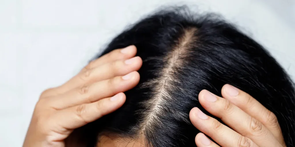 Dry and Frizzy Hair: 5 Causes & Easy Fix for Dry and Frizzy Hair 3 Close up of dry hair with split ends and rough texture